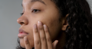How CBD Cream Can Alleviate Skin Issues Like Eczema