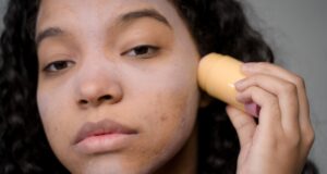 Tips For Preventing Common Skin Conditions Affecting Women